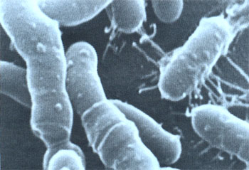 Общий вид пропионово-кислых бактерий в сканирующем микроскопе (х 60 000)